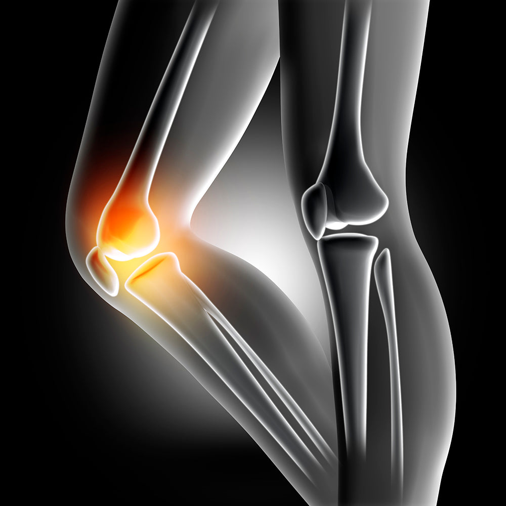 Pack de 2 Rodilleras Sujeción Suave y Cómoda