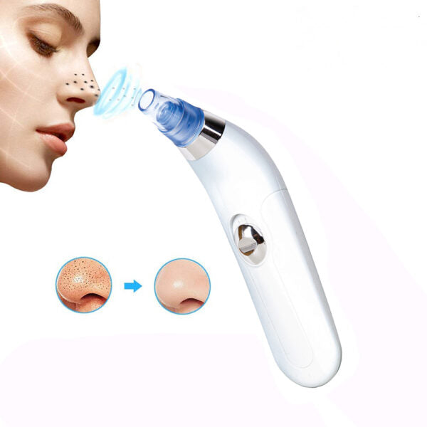 Limpiador Facial de Succión para Poros y Puntos Negros, limpieza facial,