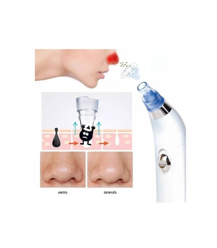 Limpiador Facial de Succión para Poros y Puntos Negros, limpieza facial,